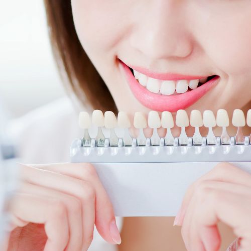 岡山の歯医者で審美歯科治療