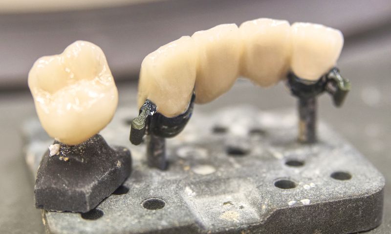 岡山の歯医者で審美セラミック治療